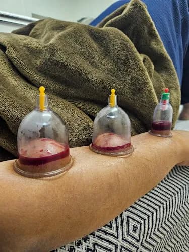 Meraki Cupping photo 2