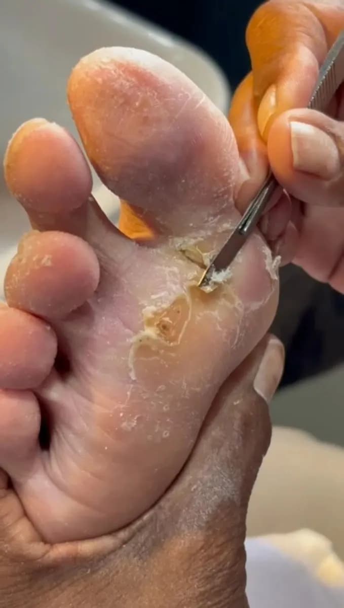 The Foot Fairy C.T.