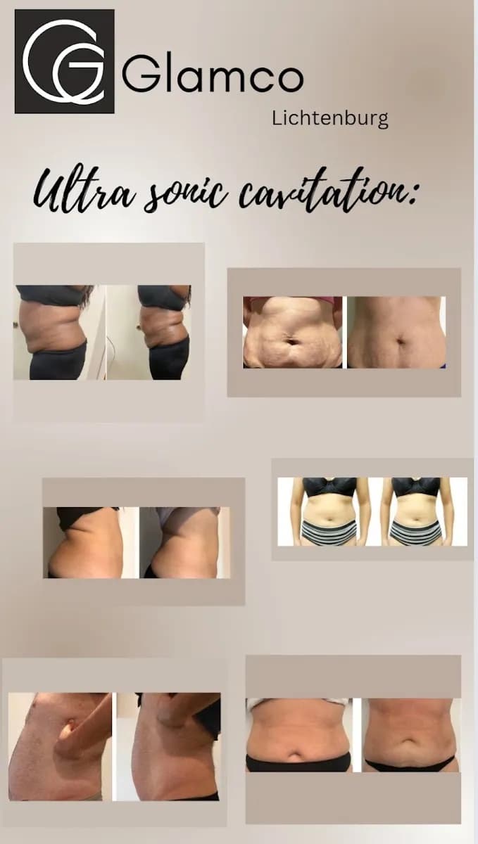 Fat Freeze and fat Dissolving injections and sunbed services