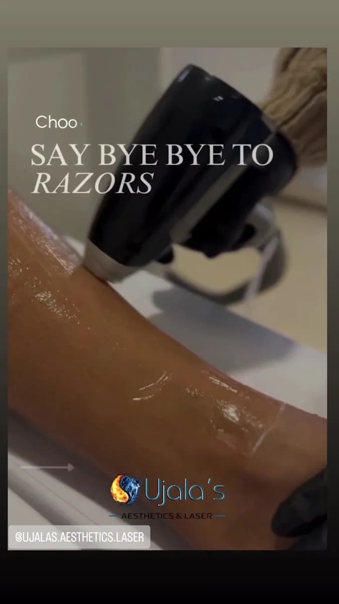 Ujala's Aesthetics and Laser