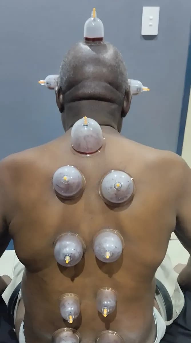 Velvet Cupping Clinic