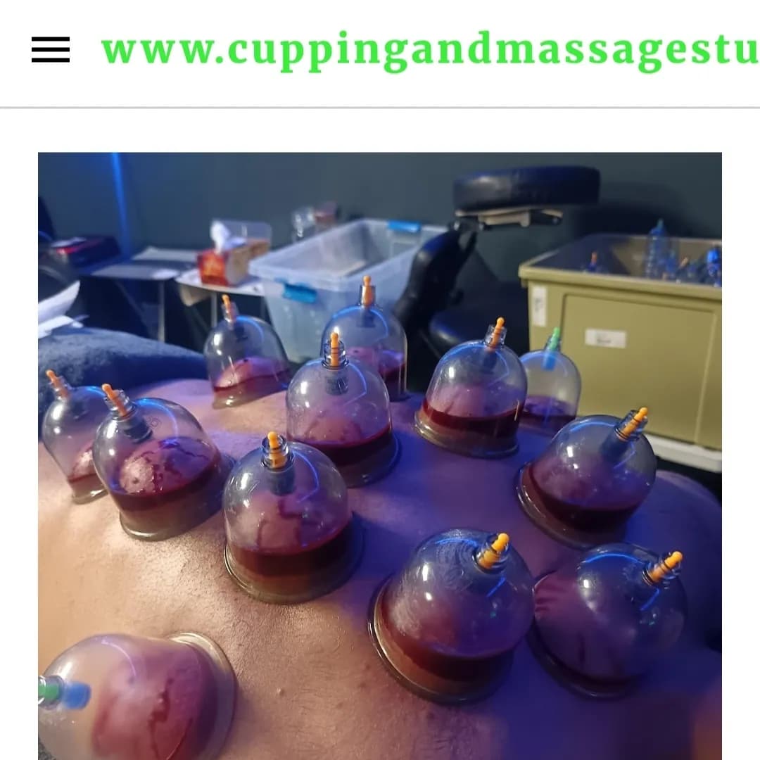 Cupping and Massage studio Robertsham by Hfz Zubair and khadijah