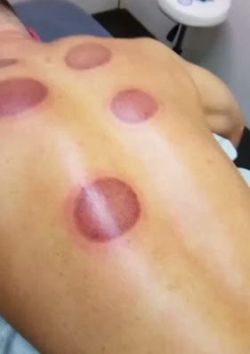 AF1QipMIDz2JksAtkkgnYqB8RD81bVU14BwbAP3hqJFBw800 h500 k no