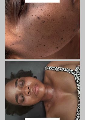 AF1QipNWsD6aikbdPPvjHH9XIdqkMFEajxXn7PkszPmZw800 h500 k no