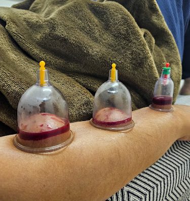 AF1QipNfqFNcr1waPgRShGvyLZvma3lvl7Jc6bfLGSNUw800 h500 k no